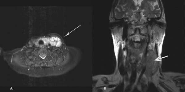 丰润区洱海海菜美图高清